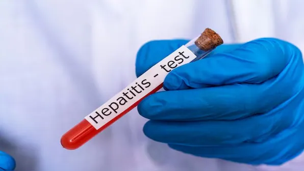 Viral Hepatitis